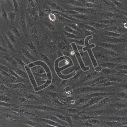 人原代肺動(dòng)脈內(nèi)皮細(xì)胞