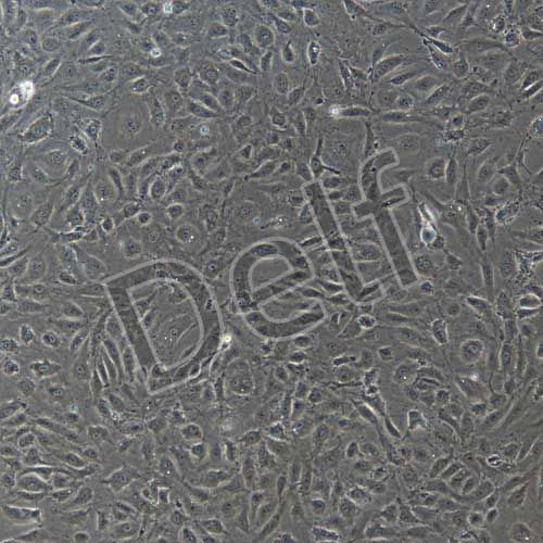 人原代肺微血管內(nèi)皮細胞