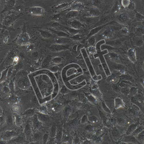 人原代肺微血管內(nèi)皮細胞