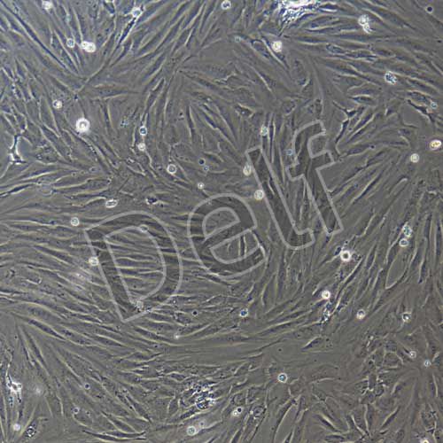 人風(fēng)濕性關(guān)節(jié)滑膜成纖維細(xì)胞永生化-SV40