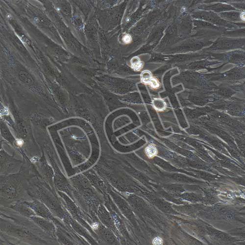 人風(fēng)濕性關(guān)節(jié)滑膜成纖維細(xì)胞永生化-SV40