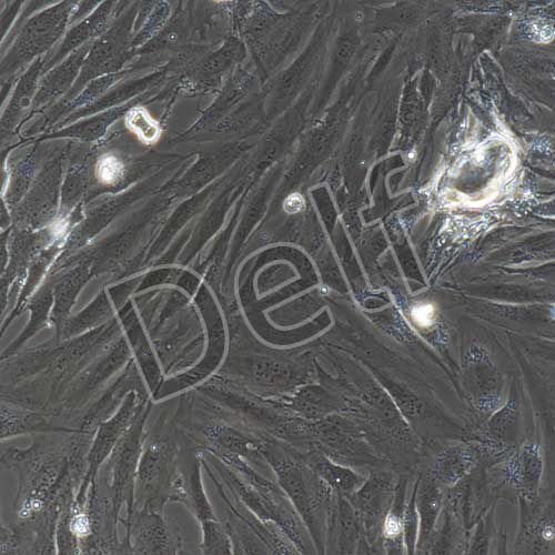 人風(fēng)濕性關(guān)節(jié)滑膜成纖維細(xì)胞永生化-SV40