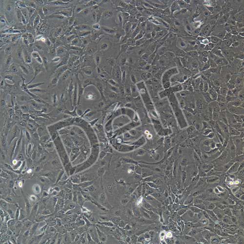 人原代宮頸上皮細(xì)胞