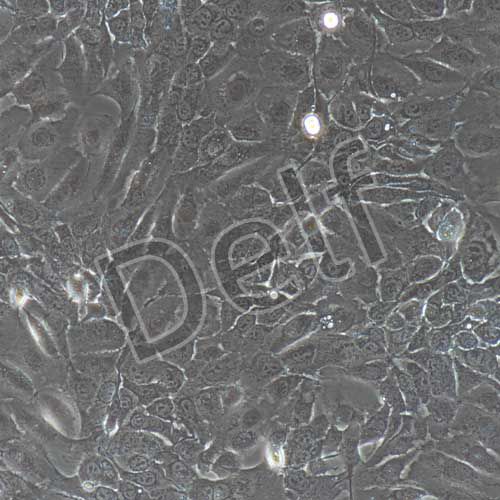 人原代宮頸上皮細(xì)胞