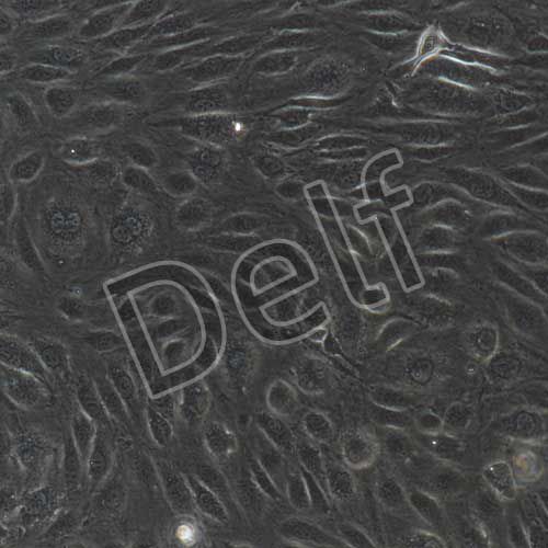 人原代骨骼肌微血管內(nèi)皮細(xì)胞