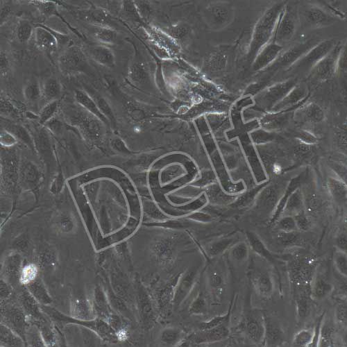 人原代骨微血管內(nèi)皮細(xì)胞