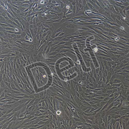 人原代冠狀動脈平滑肌細(xì)胞