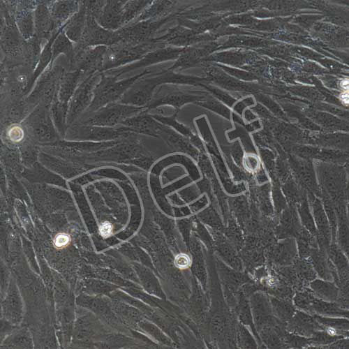 人原代冠狀動脈平滑肌細(xì)胞