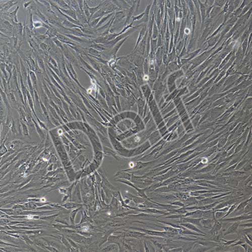 人甲狀旁腺細(xì)胞永生化