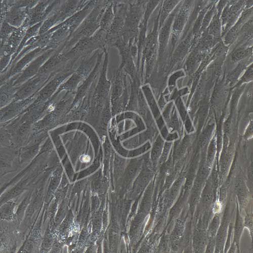 人甲狀旁腺細(xì)胞永生化