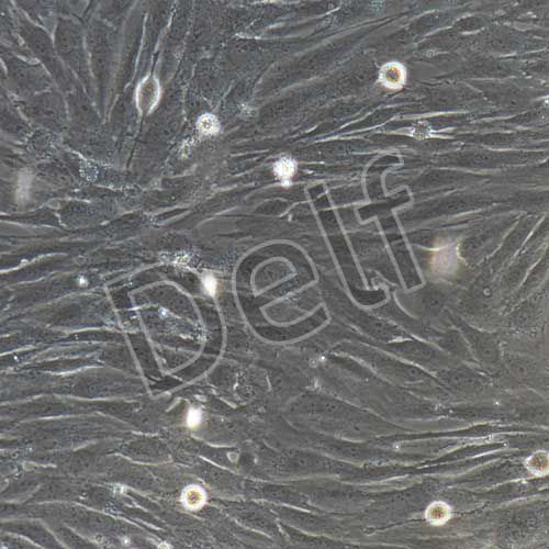 人原代甲狀腺成纖維細(xì)胞