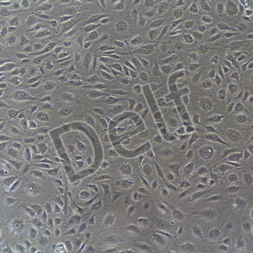 人原代甲狀腺微血管內(nèi)皮細胞