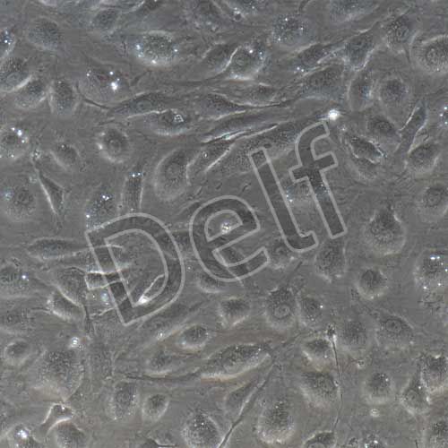 人原代甲狀腺微血管內(nèi)皮細胞