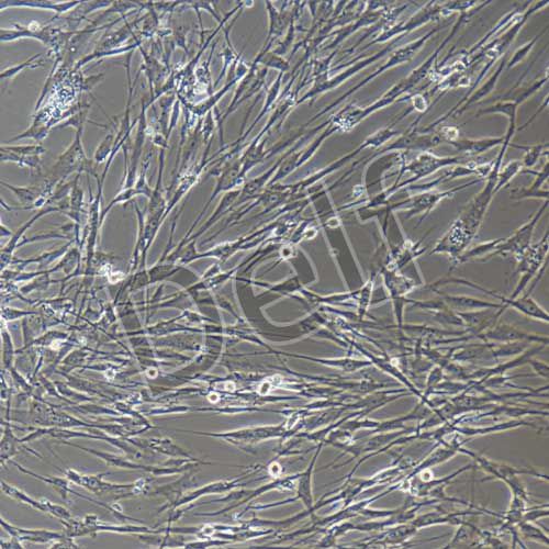 人頸靜脈球瘤細(xì)胞永生化