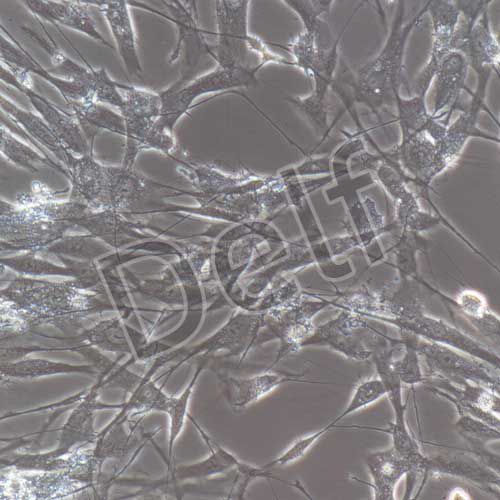 人頸靜脈球瘤細(xì)胞永生化
