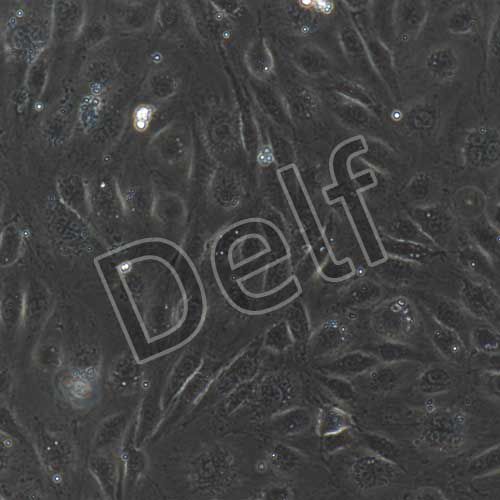 人淋巴管內(nèi)皮細(xì)胞永生化-sv40