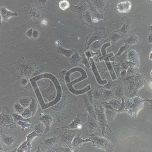 人卵巢癌細(xì)胞永生化