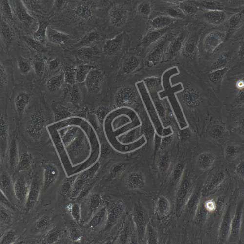 人原代腦微血管內(nèi)皮細胞