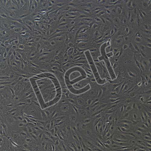 人原代臍動脈內(nèi)皮細胞