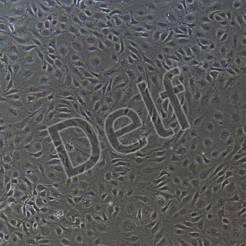 人原代臍靜脈內(nèi)皮細(xì)胞