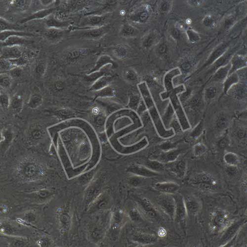 人原代臍靜脈內(nèi)皮細(xì)胞