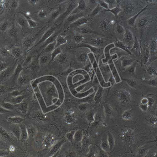 人原代臍靜脈內(nèi)皮細(xì)胞