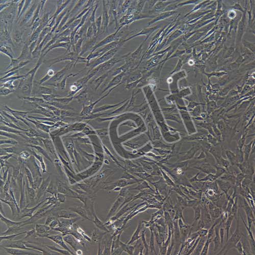 人前庭鞘膜瘤細胞永生化