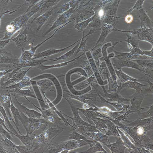 人前庭鞘膜瘤細胞永生化