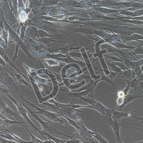 人前庭鞘膜瘤細胞永生化