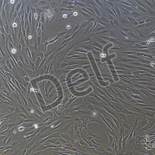 人乳腺癌成纖維細(xì)胞永生化