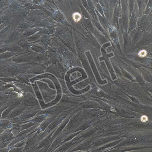 人乳腺癌成纖維細(xì)胞永生化