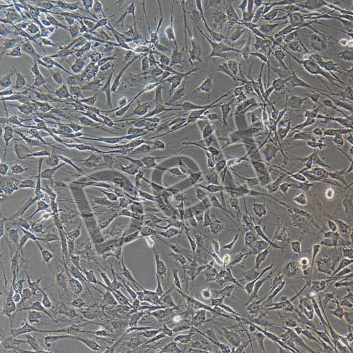 人神經(jīng)鞘膜瘤細(xì)胞永生化