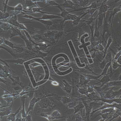 人神經(jīng)鞘膜瘤細(xì)胞永生化