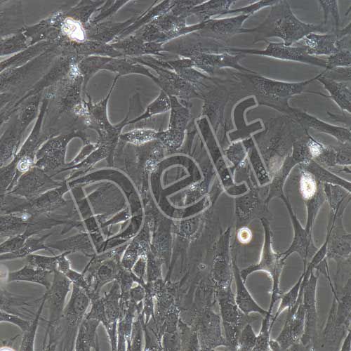 人原代食管癌細(xì)胞