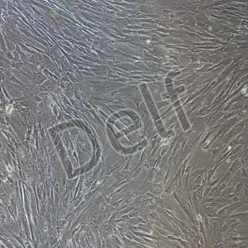 人原代胎盤間充質(zhì)干細(xì)胞