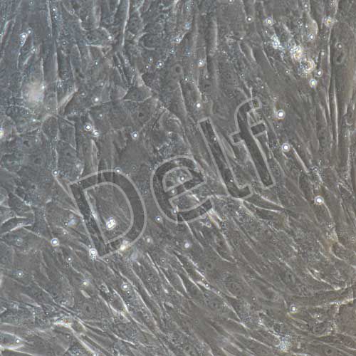 人原代胎盤間充質(zhì)干細(xì)胞