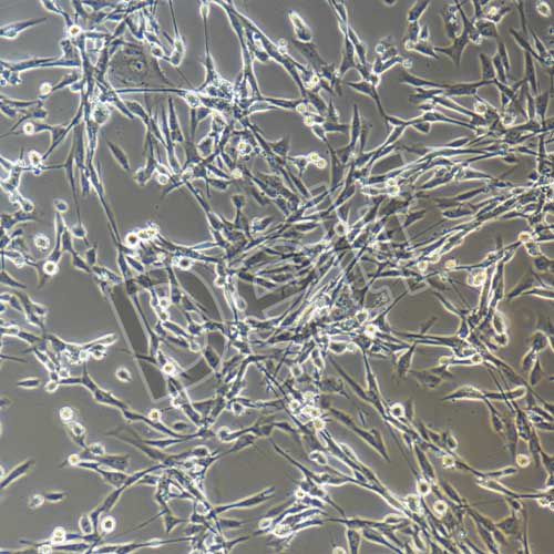 人腸息肉上皮細(xì)胞永生化