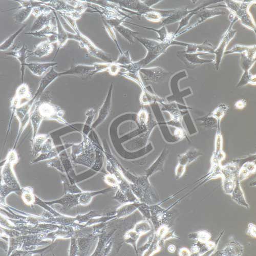 人腸息肉上皮細(xì)胞永生化