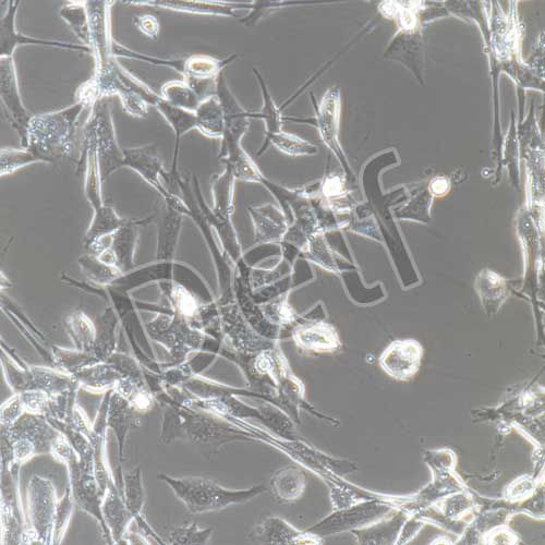 人腸息肉上皮細(xì)胞永生化