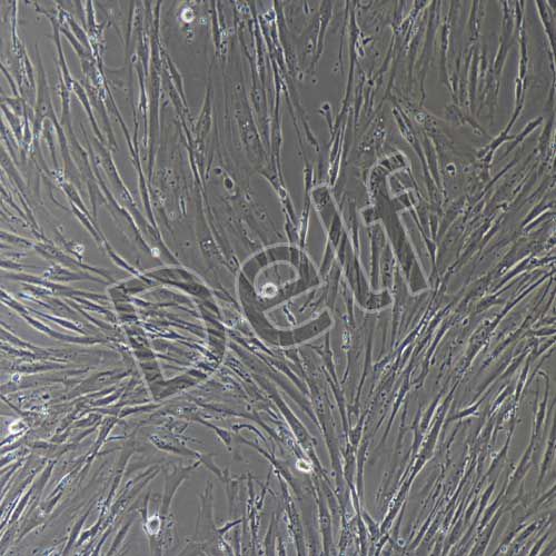 人原代胰腺星狀細(xì)胞