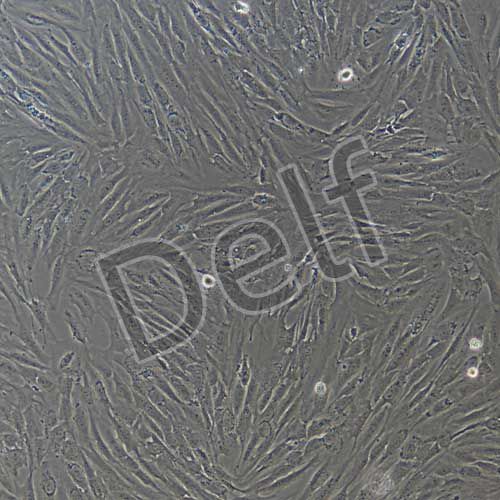 人胰腺腫瘤成纖維細胞永生化