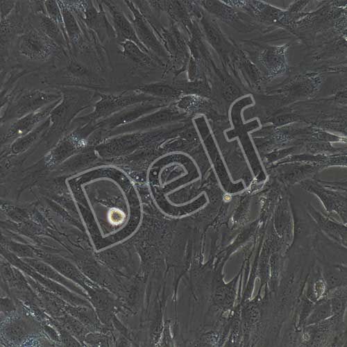 人胰腺腫瘤成纖維細胞永生化