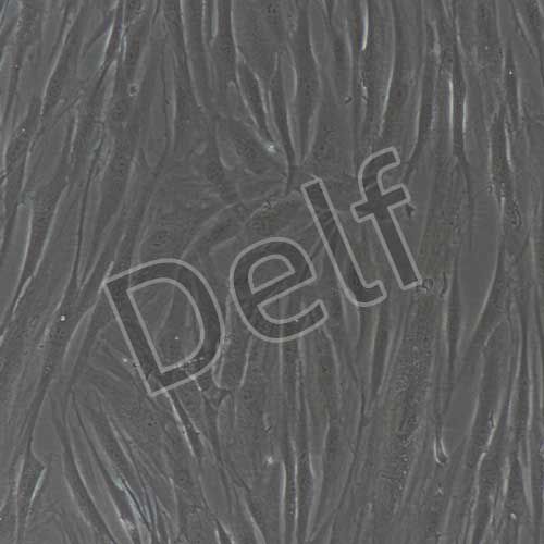 人原代增生性瘢痕成纖維細胞