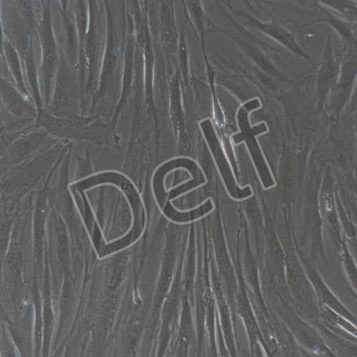 人原代增生性瘢痕成纖維細胞