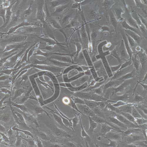 人原代真皮微血管內(nèi)皮細(xì)胞