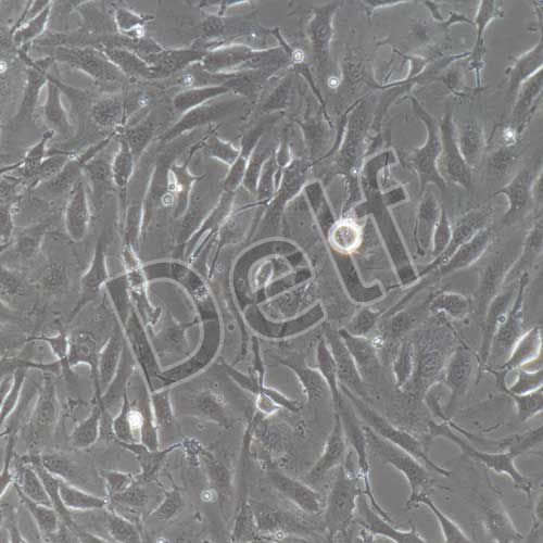 人原代真皮微血管內(nèi)皮細(xì)胞