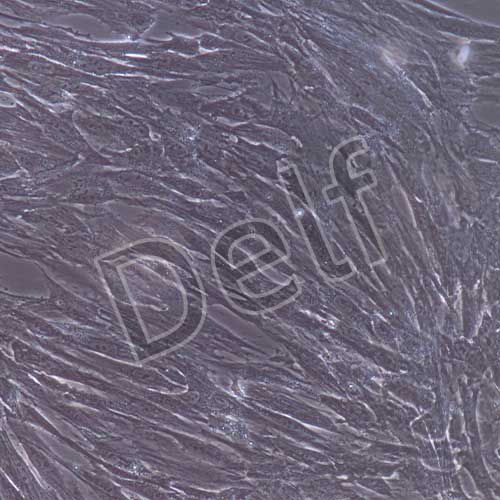 人原代主動(dòng)脈瓣膜間質(zhì)細(xì)胞