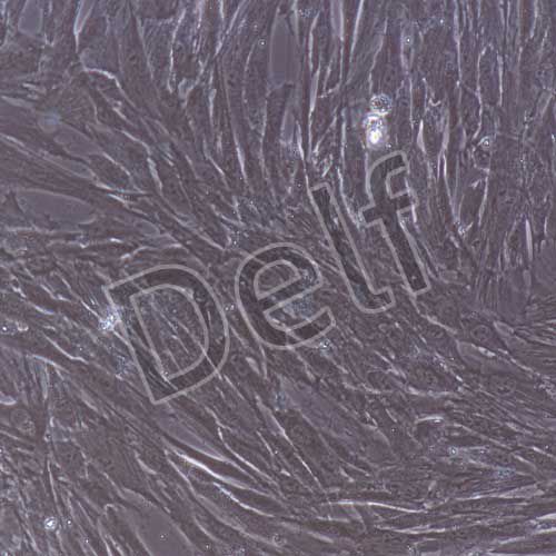 人原代主動(dòng)脈瓣膜間質(zhì)細(xì)胞