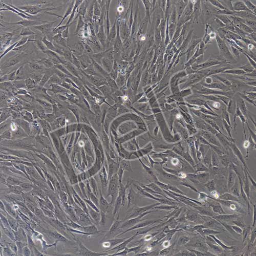 人主動(dòng)脈瓣膜間質(zhì)細(xì)胞永生化