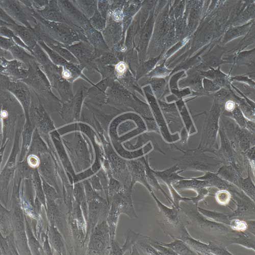 人主動(dòng)脈瓣膜間質(zhì)細(xì)胞永生化